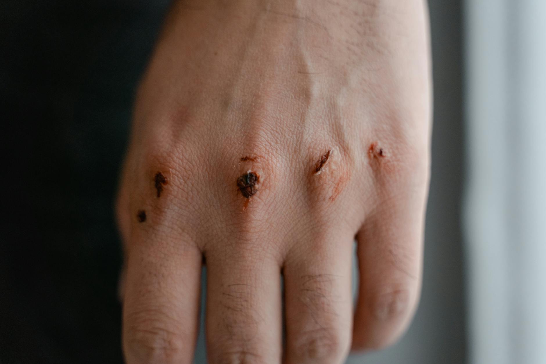 The Knuckle-Cracking Arthritis Warning Is Almost Certainly Wrong — Here's the Strange Story Behind It