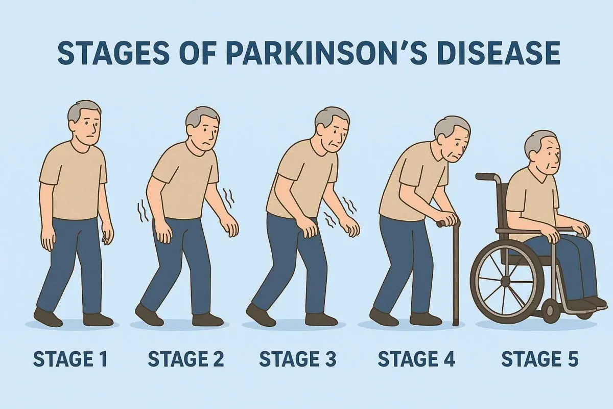 Parkinson's disease